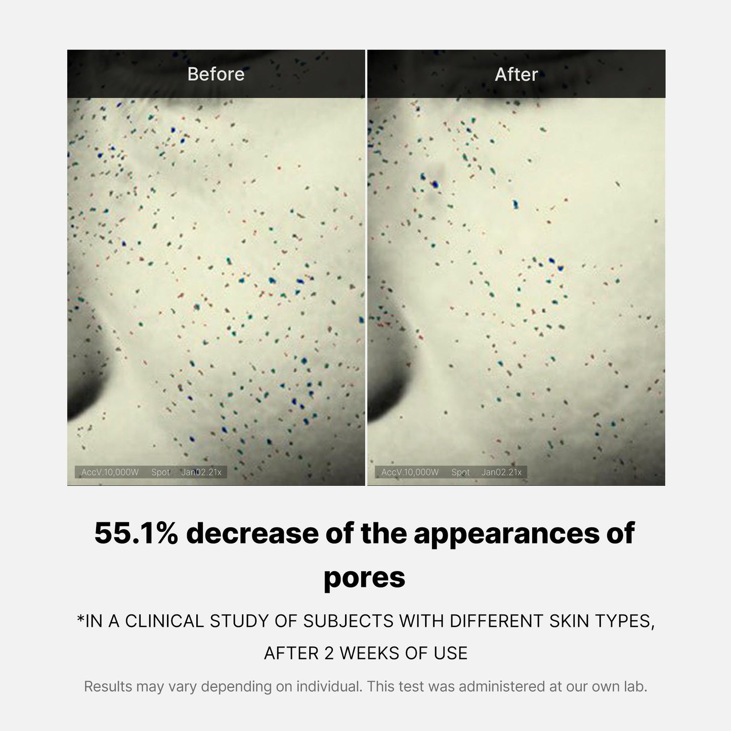 pore-care-duo-q2 05_12ddab8a-64be-4612-8ee1-27e5ec701921.jpg