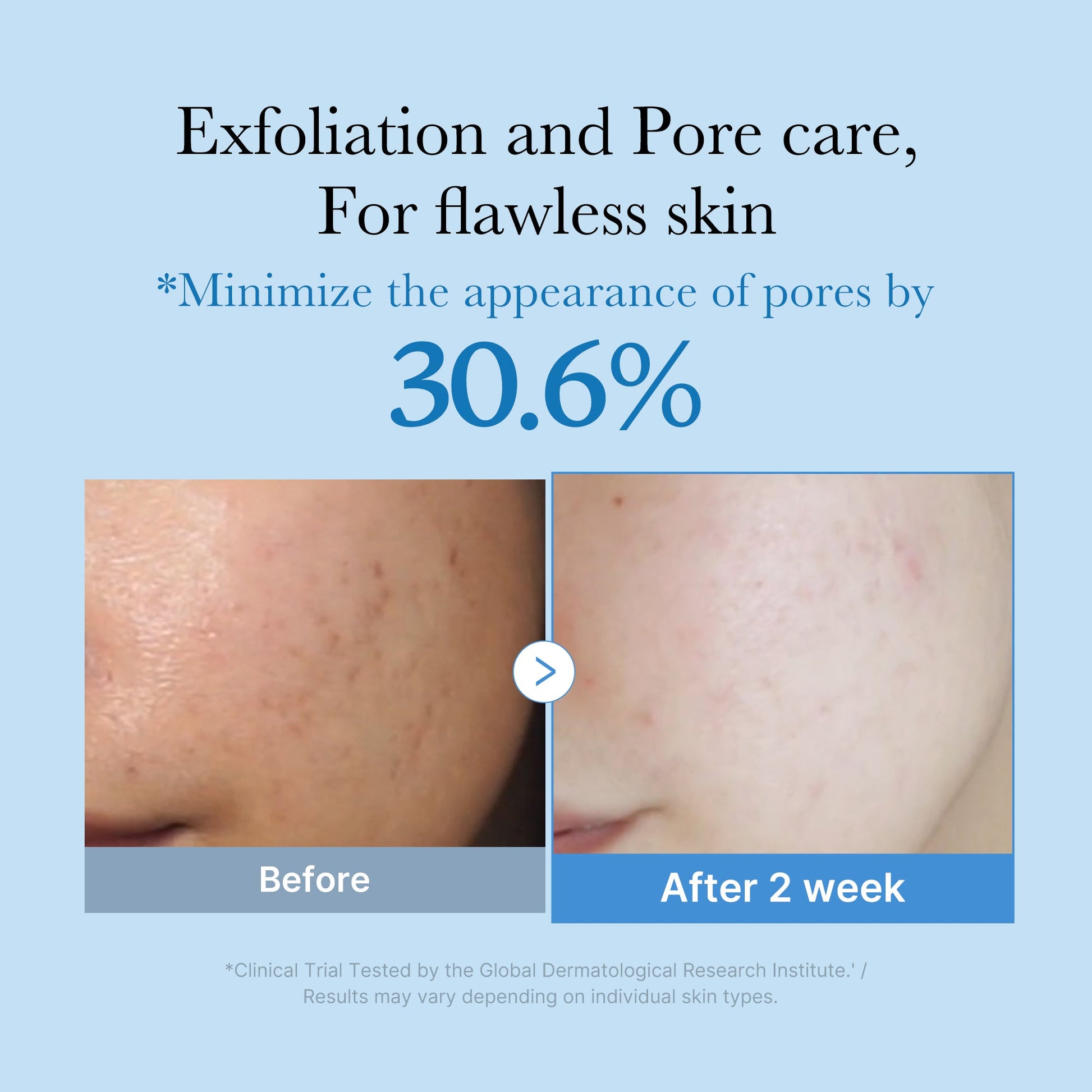 zero-pore-toner-p2 01_d6480b4e-3c08-4954-994a-ed5212c1839c.jpg