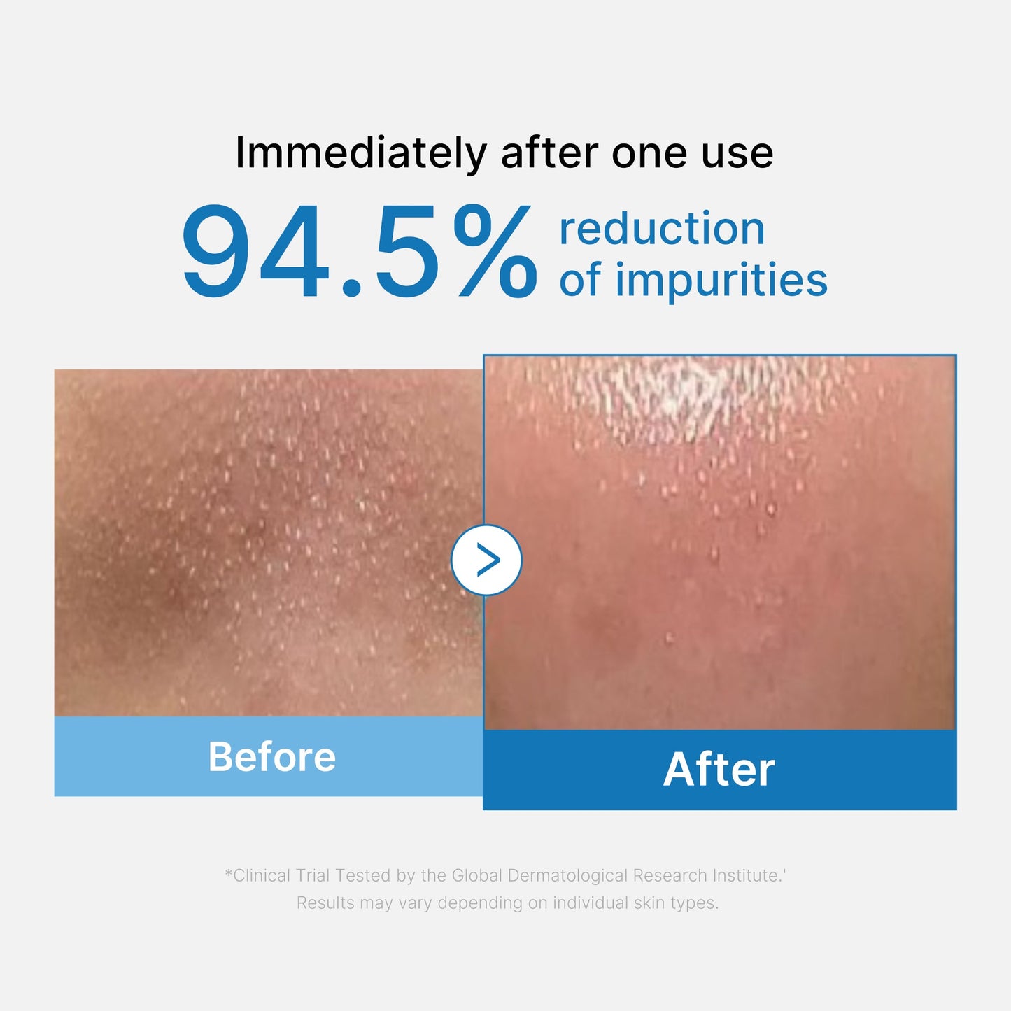 zero-pore-blackhead-deep-cleansing-oil-k3 01_eed557ec-5857-46a2-8b17-dbd67c692dcb.jpg