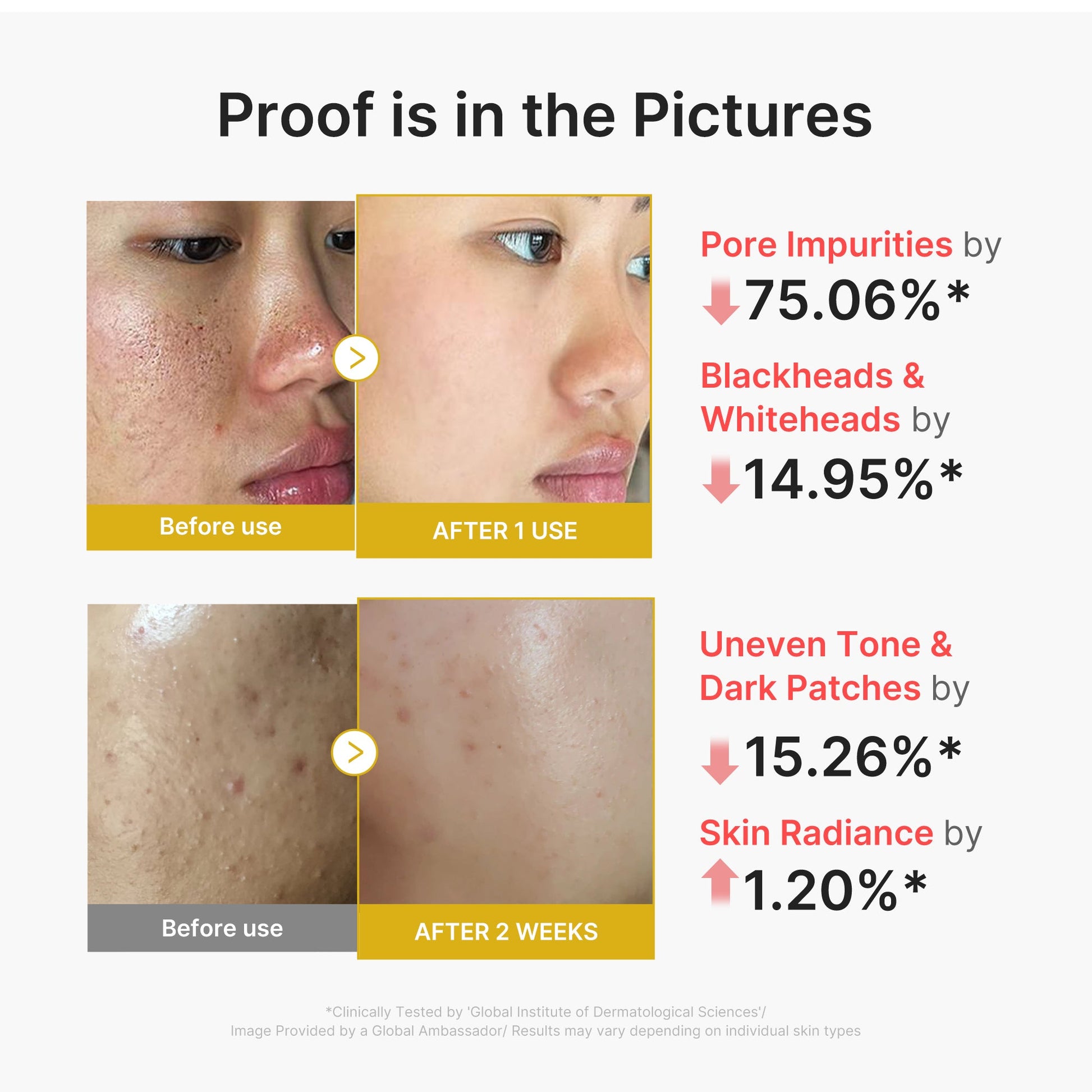 kojic-acid-turmeric-peel-shot-x3 02_45fe66d3-b3f6-4100-aa52-2afd7eded417.jpg