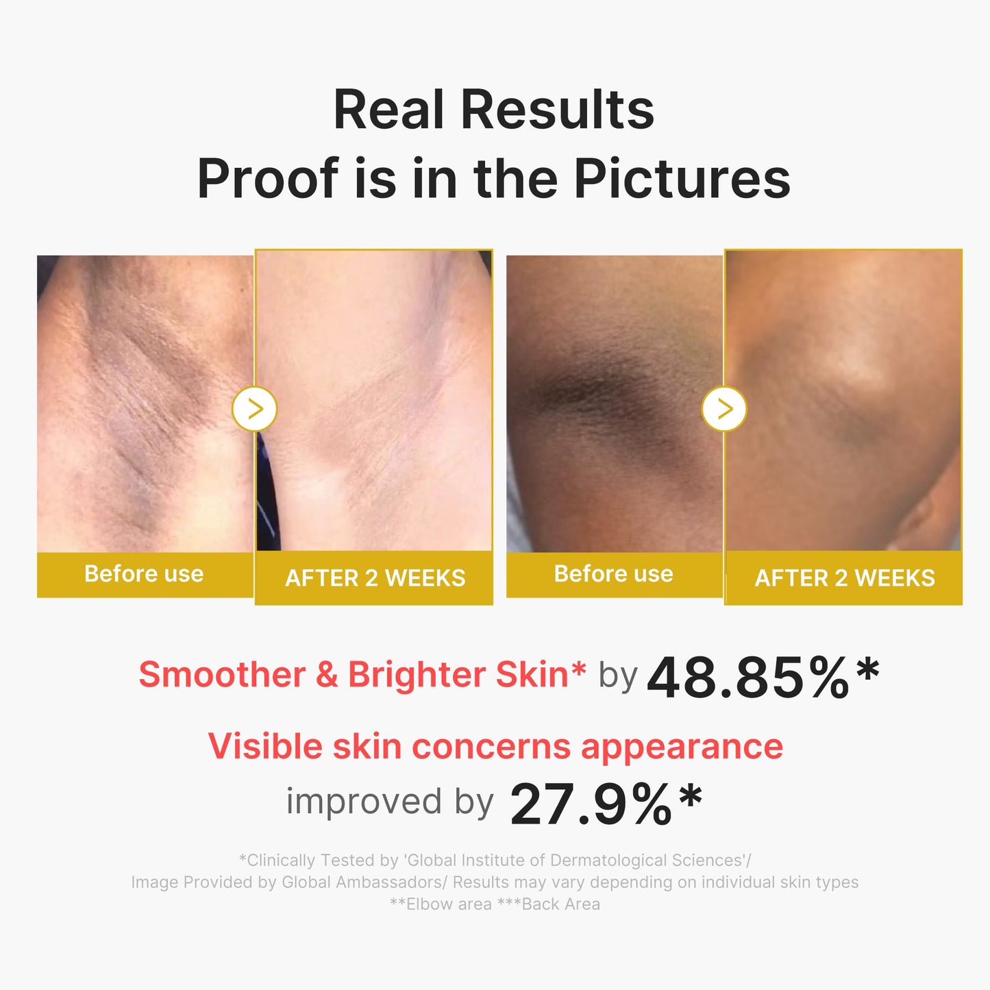 kojic-acid-turmeric-body-peel-shot-y4 02_72880cfc-382b-440b-8152-7e3dce87da2a.jpg