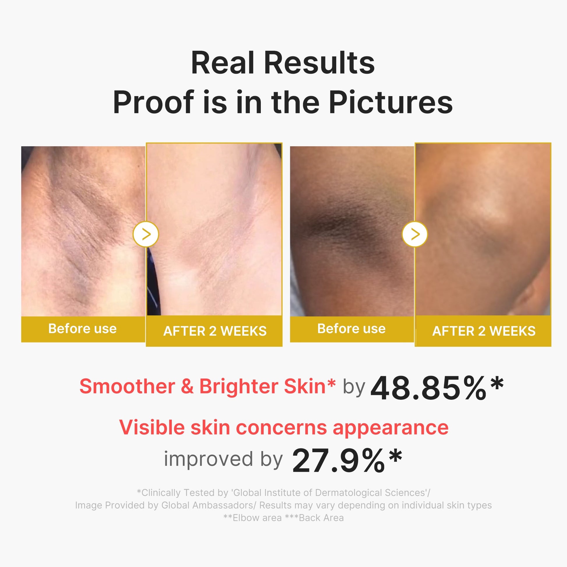 kojic-acid-turmeric-body-peel-shot-y4 02_72880cfc-382b-440b-8152-7e3dce87da2a.jpg