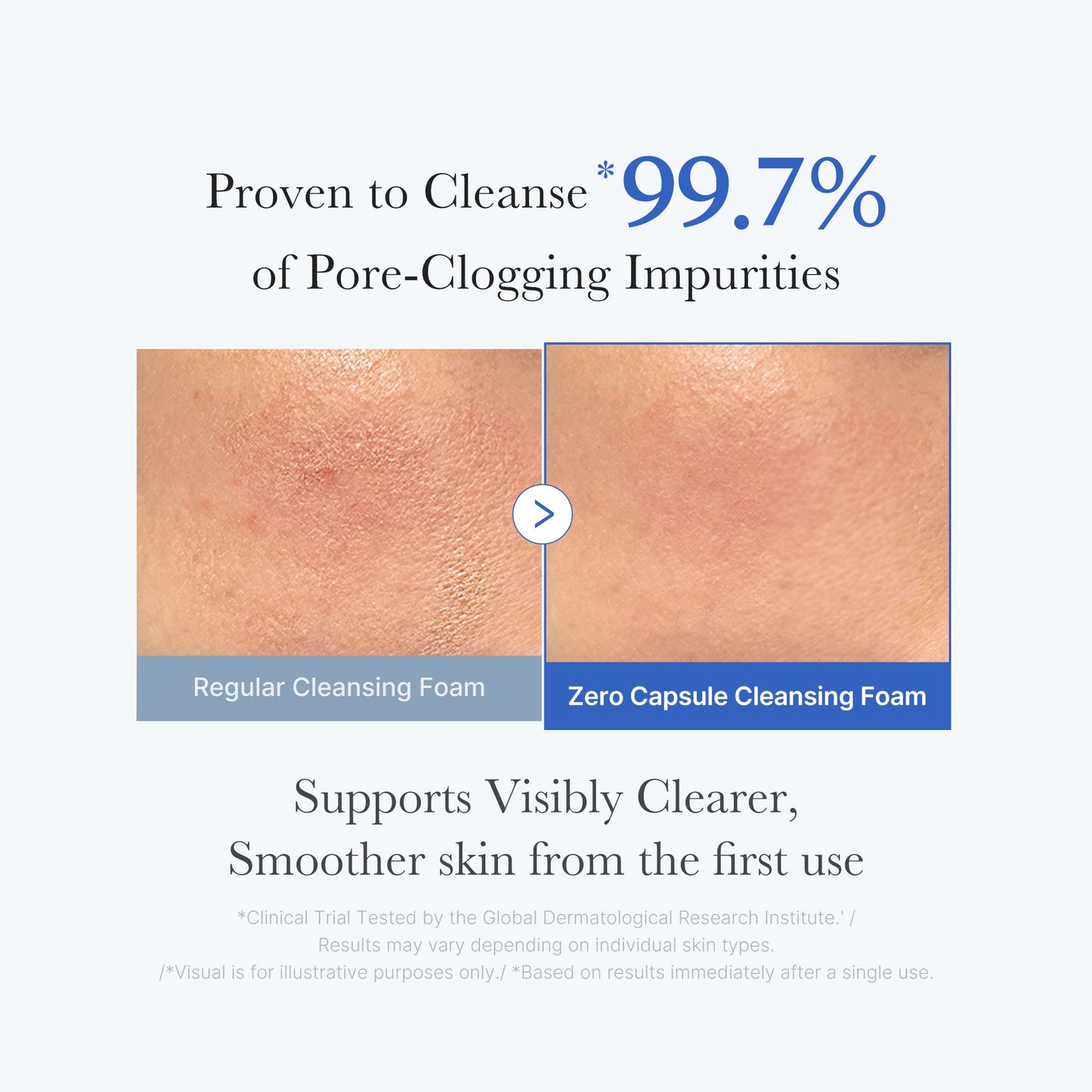 zero-pore-capsule-cleansing-foam-v1 02_c1fb9dfb-86c5-4038-8ff8-490d1006276c.jpg