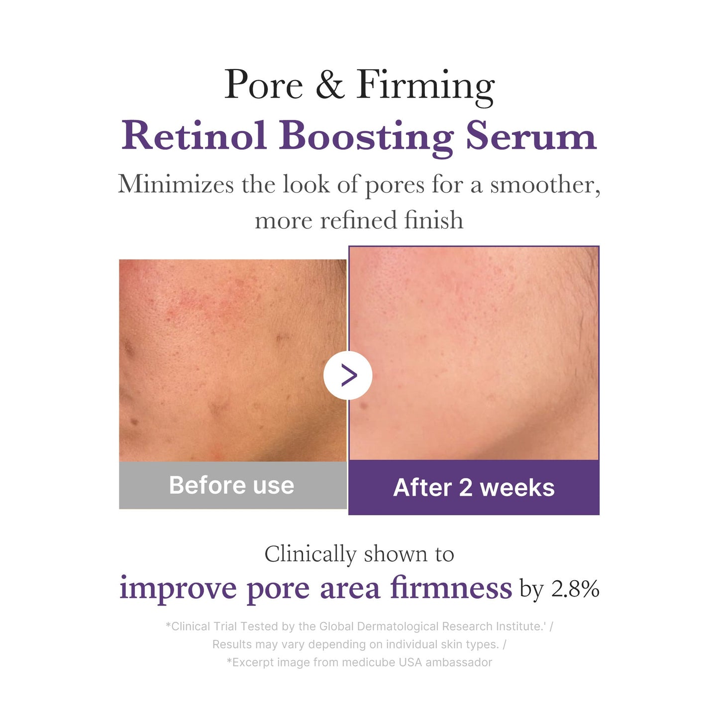 retinol-nmn-boosting-serum-j9 03_3510e7a5-5633-4a18-81ea-1389593bd517.jpg