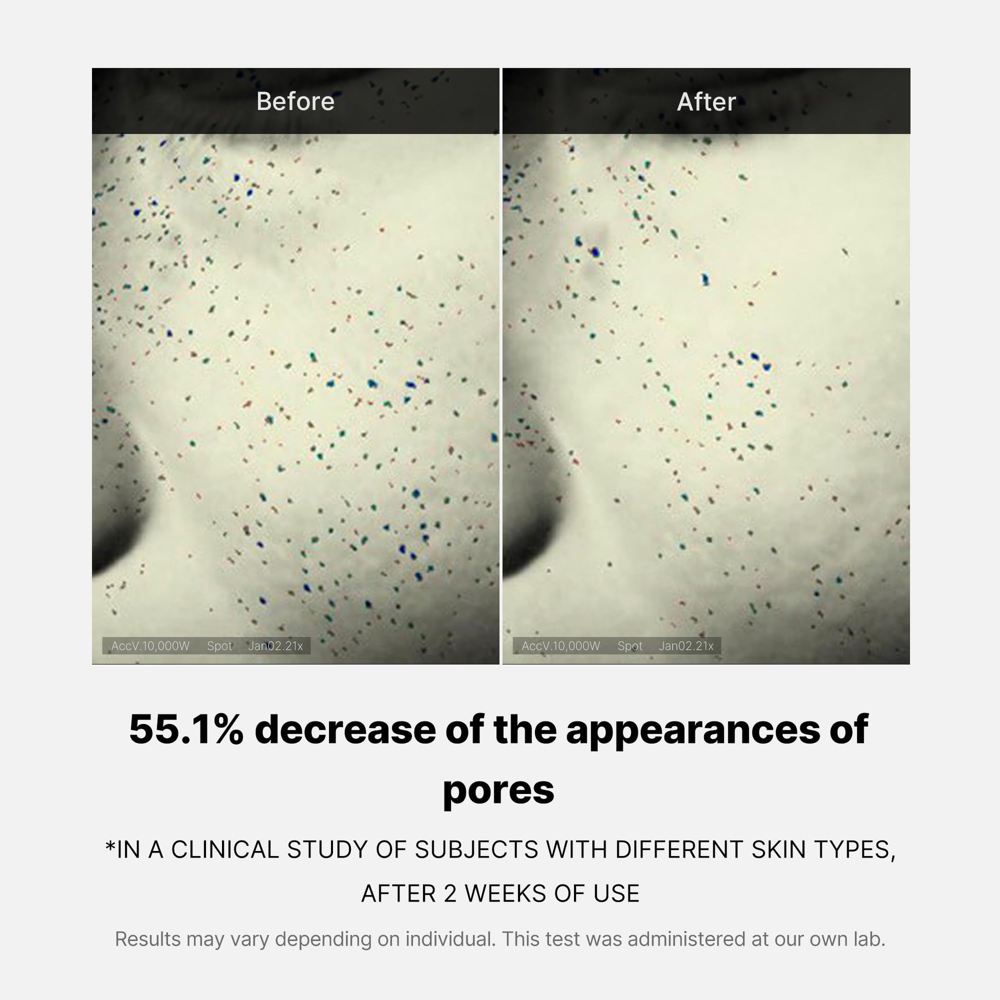 zero-pore-one-day-cream-p8 04_3616addc-f184-4deb-a5d7-e3a782e4713d.jpg