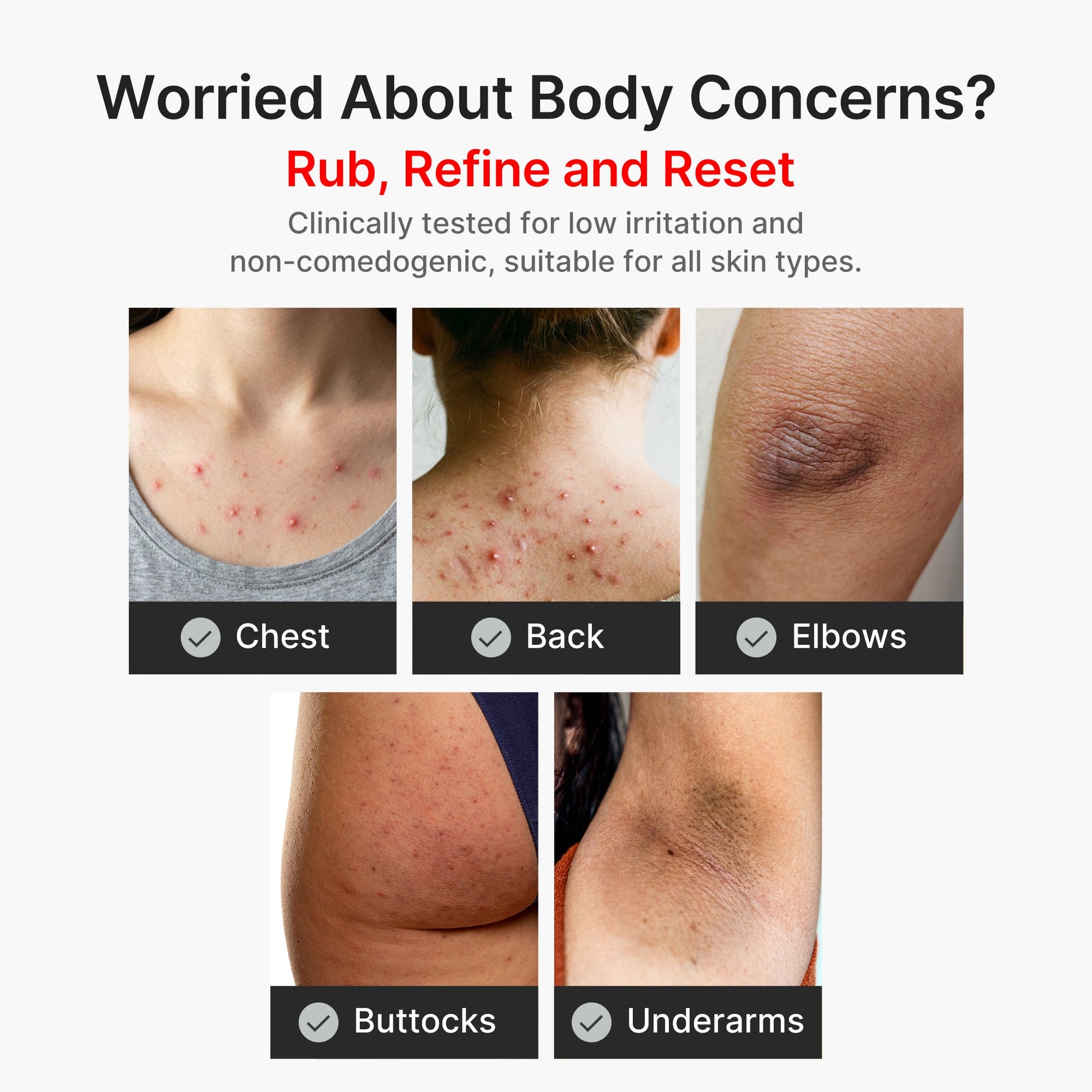 kojic-acid-turmeric-body-peel-shot-y4 04_8a7237f2-3ebf-401e-bd85-54841aeb3efc.jpg
