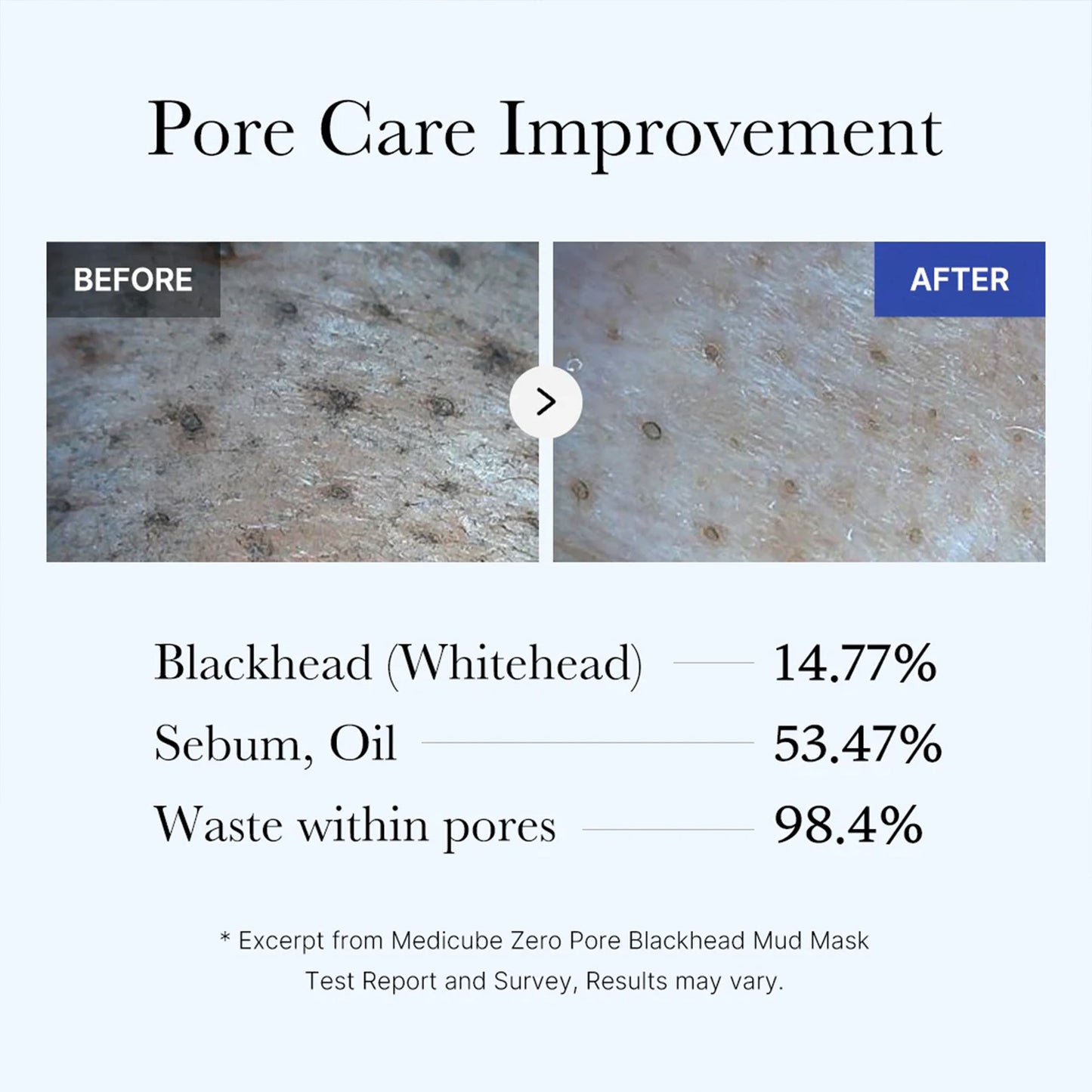 zero-pore-blackhead-mud-mask-g8 05_9362a158-c2b3-4525-acc0-631a2cfdea47.jpg