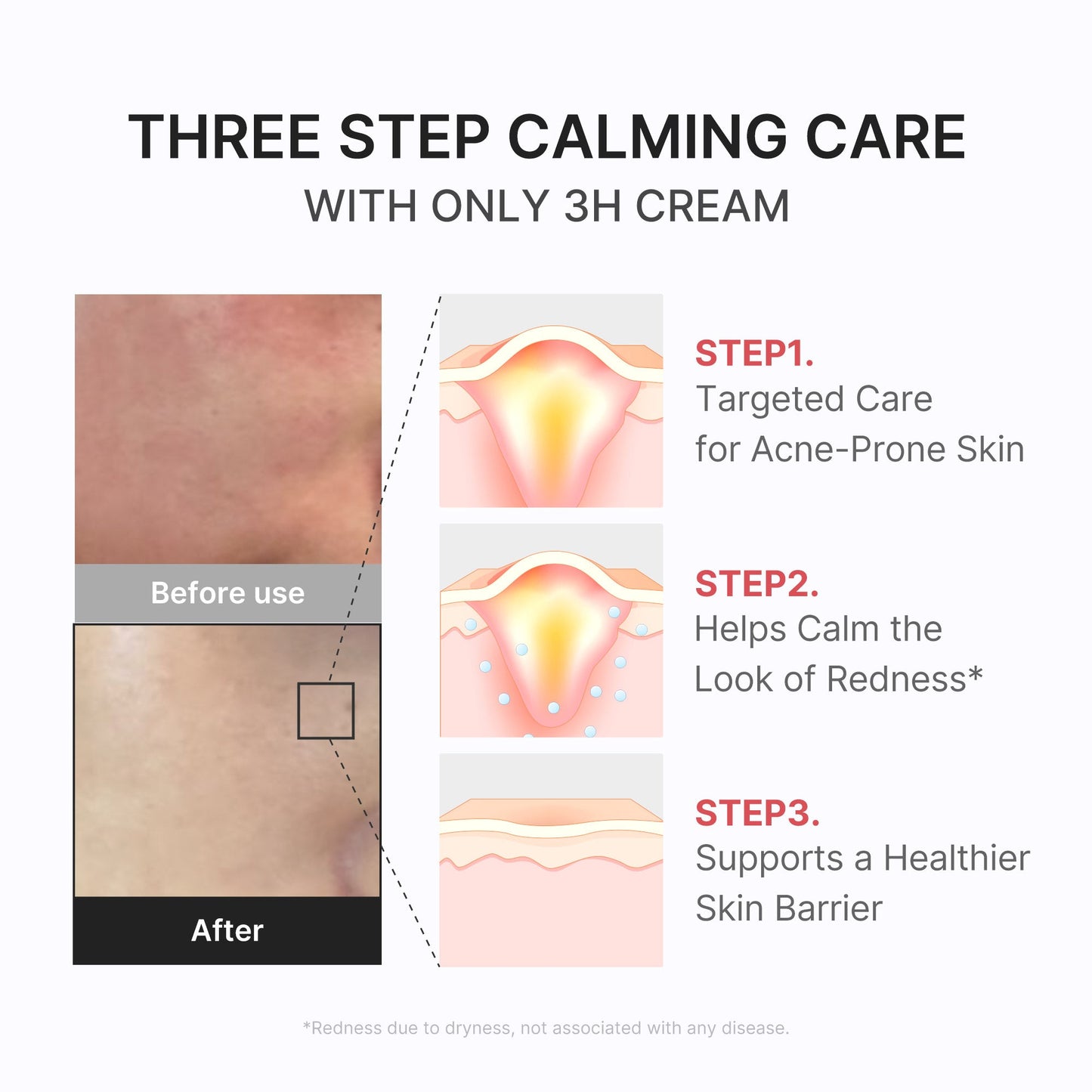 3h-daily-relief-cream-c3 3H_04.jpg