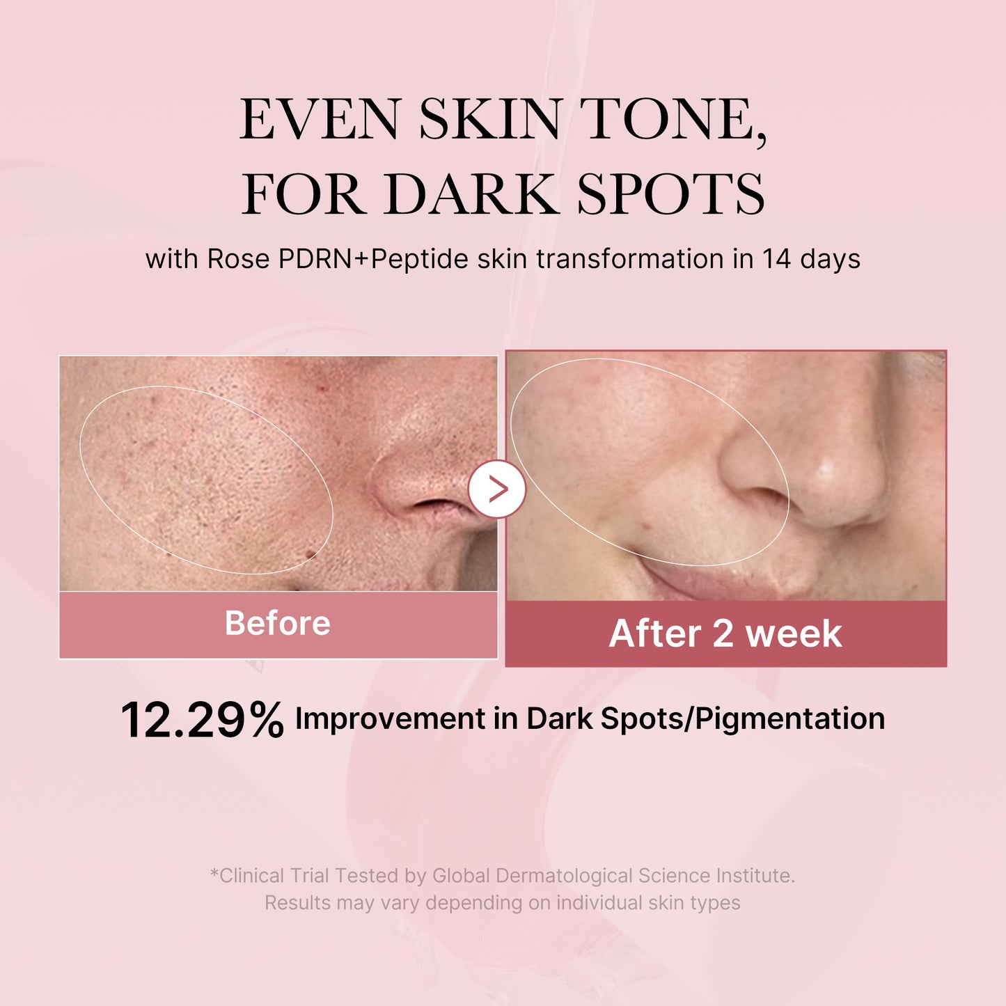 pdrn-pink-peptide-toner-t7 PDRN_01_308c518e-5ac6-4e54-99bd-eabc8796739b.jpg