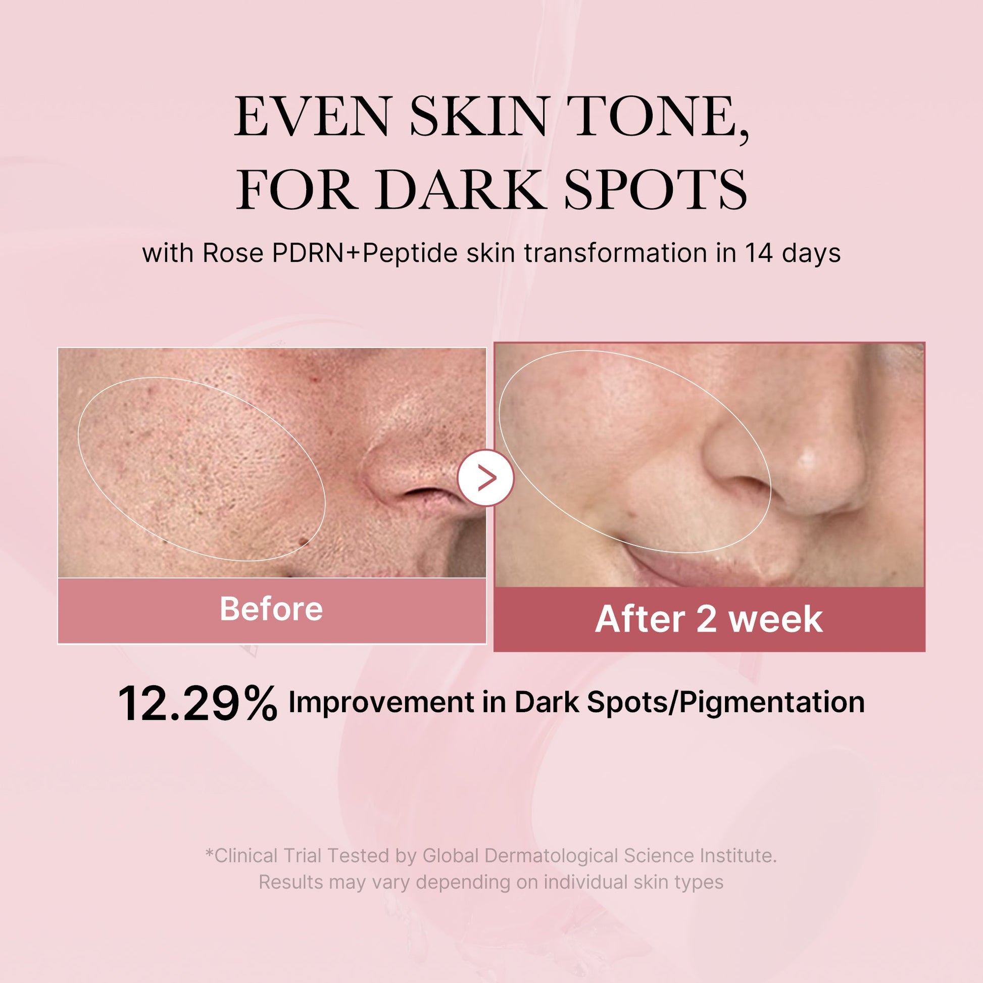 pdrn-pink-peptide-toner-t7 PDRN_01_308c518e-5ac6-4e54-99bd-eabc8796739b.jpg