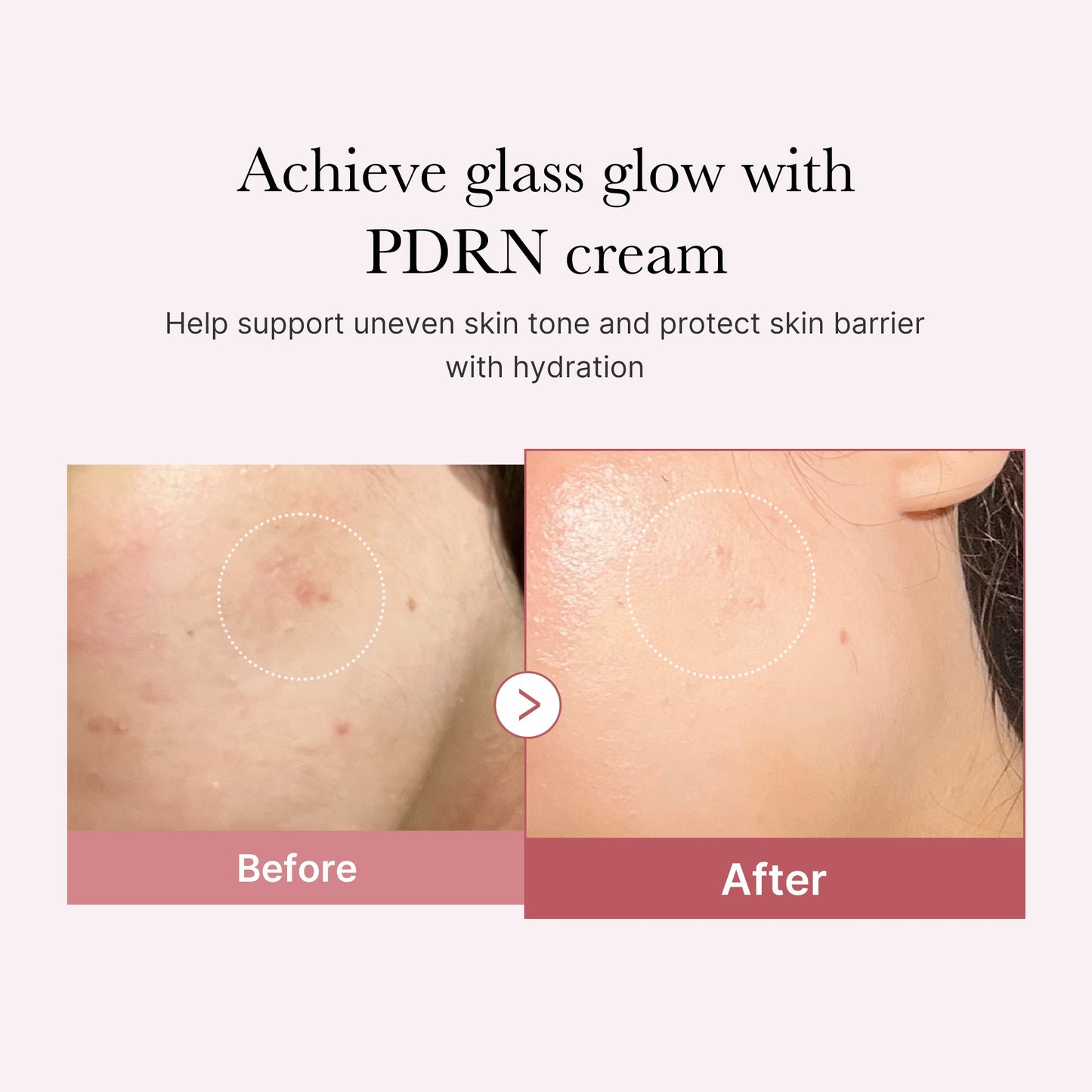 pdrn-pink-peptide-cream-b1 PDRN_02_d7805bfe-cf43-446a-b71b-a276683f136b.jpg