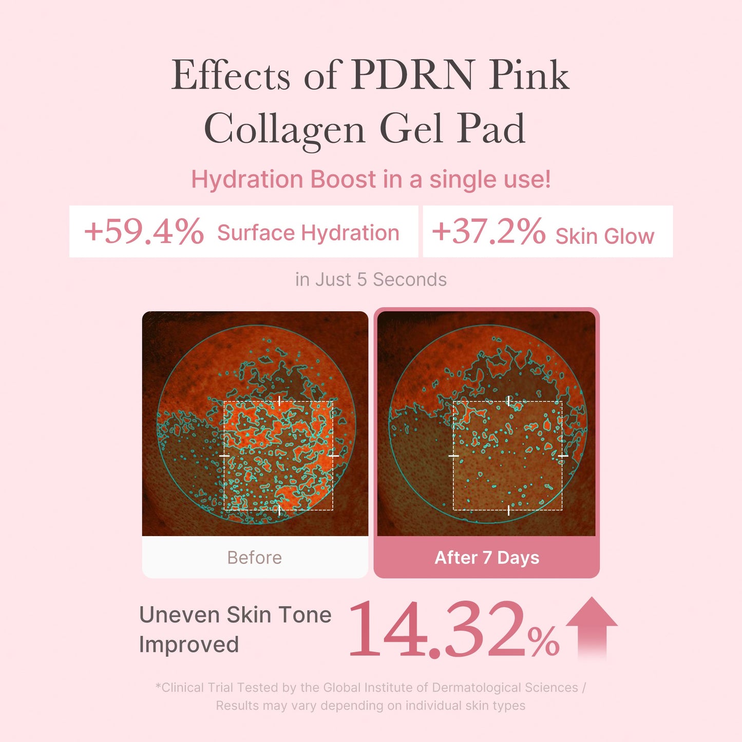 pdrn-pink-collagen-gel-toner-pad-x7 PDRN_04_f9a16a56-8d9e-4c47-a635-ed34ec3ed571.jpg