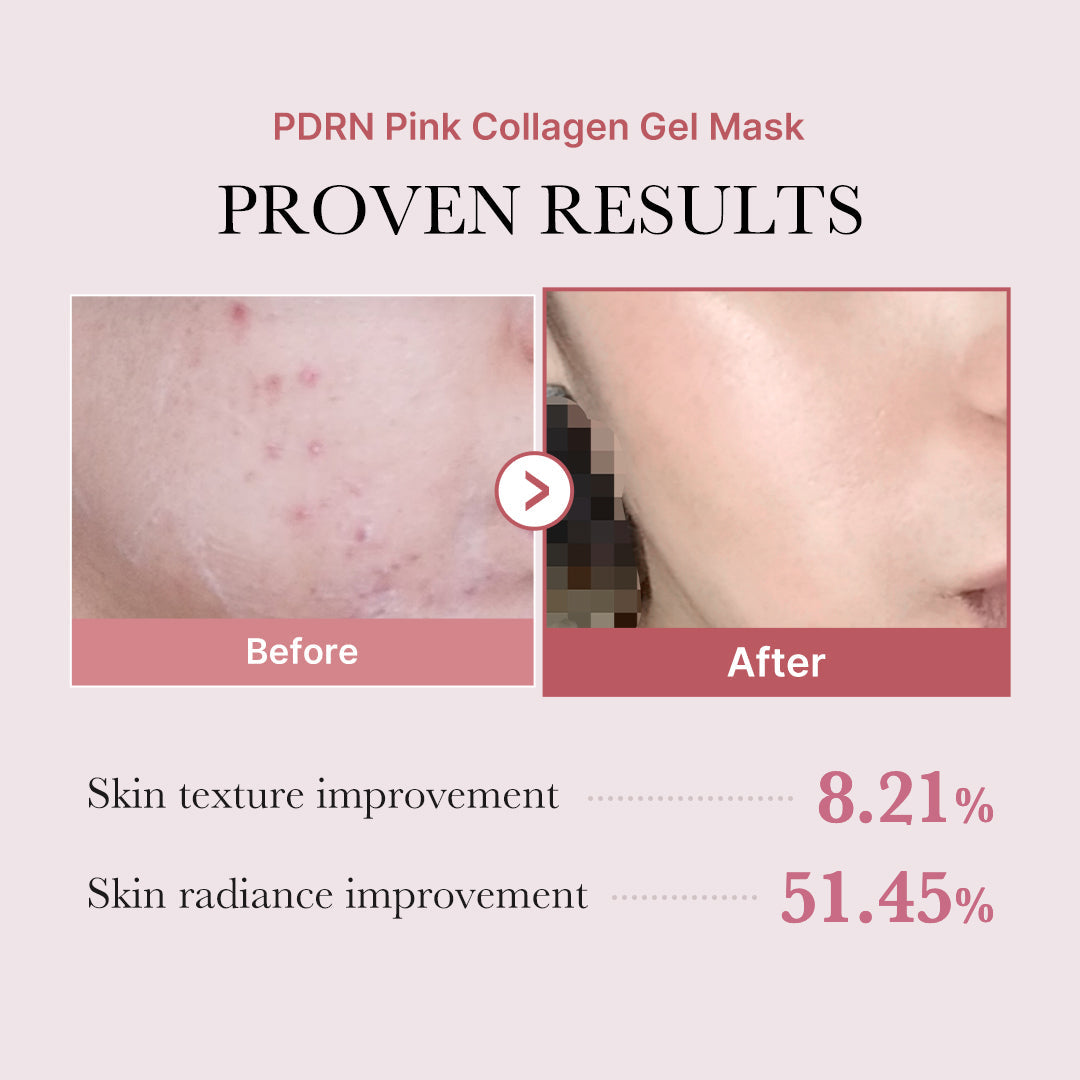 pdrn-pink-glow-full-set-m0 PDRN_12.jpg